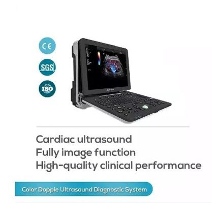 心血管の心臓学の携帯用完全なFigital色のドップラー超音波の走査器機械