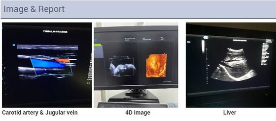 第2 3D 4Dのエコー心電図検査の心臓トロリー エコー色のドップラー超音波機械