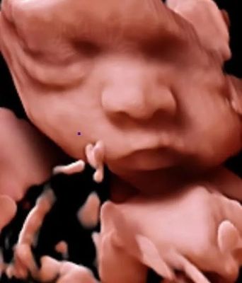 OB GYNのための3D 4D 5D色のドップラー超音波のトロリー超音波の走査器