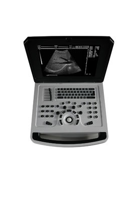 ノートブック 心臓病用のブラックアンドホワイト超音波スキャナー