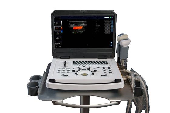 CEポータブルカラードップラー超音波スキャナー OEM