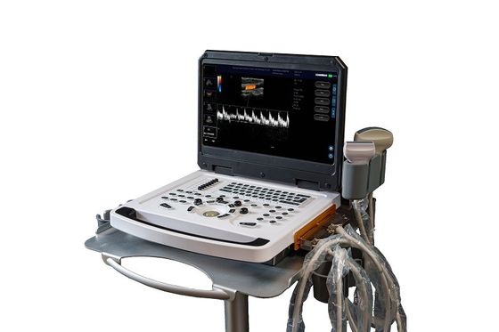 CEポータブルカラードップラー超音波スキャナー OEM